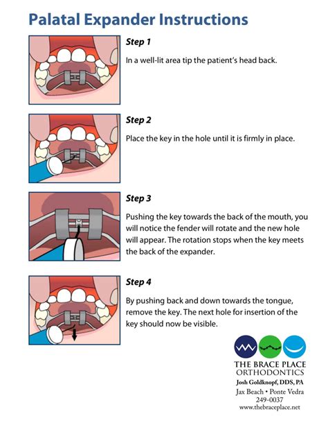 navy braces instruction.